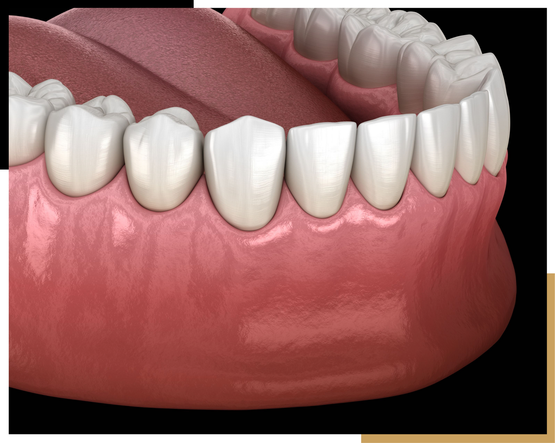 Custom Smile Design Services in Jacksonville | Cre8 Smile Studio